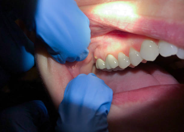 Best Tooth Pain Emergency Relief  in Thornville, OH